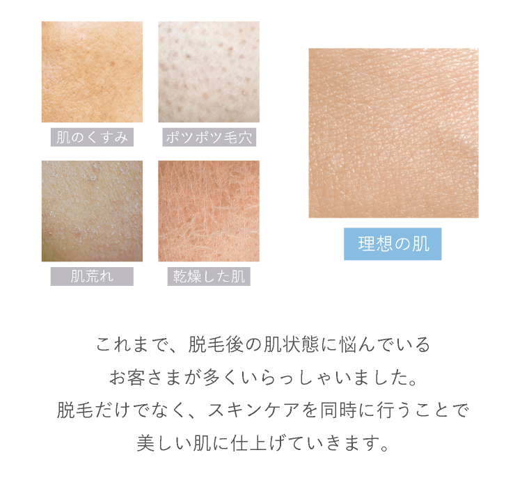 スキンケア脱毛】ワンランク上の素肌を叶える｜ミュゼ独自のトリプルケア